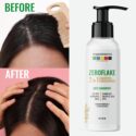 neem shampoo for dandruff