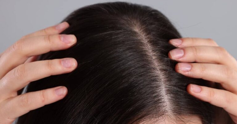 rosemary oil for hair growth